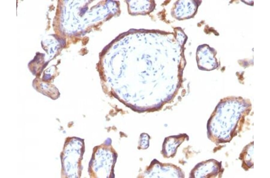Immunohistochemistry (formalin-fixed, paraffin-embedded) - Anti-EGFR Antibody [GFR1195] (CF®488A) (A353187) - Antibodies.com