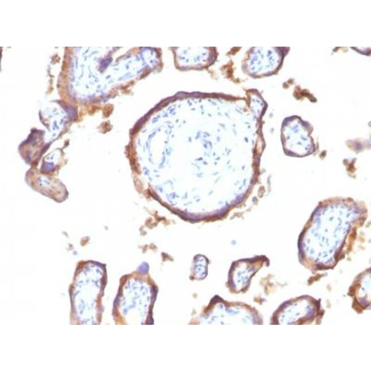 Immunohistochemistry (formalin-fixed, paraffin-embedded) - Anti-EGFR Antibody [GFR1195] (CF®488A) (A353187) - Antibodies.com