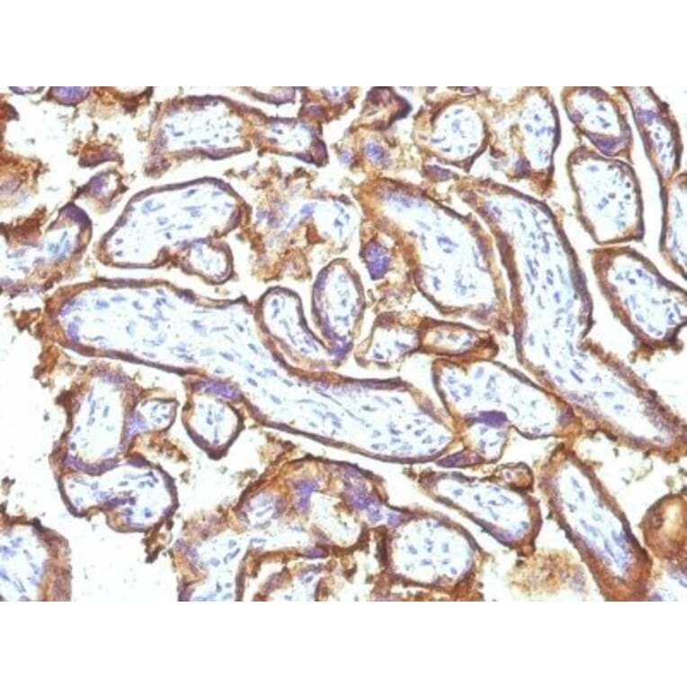 Immunohistochemistry (formalin-fixed, paraffin-embedded) - Anti-EGFR Antibody [GFR1195 + 31G7] (CF®405S) (A353190) - Antibodies.com