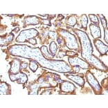Immunohistochemistry (formalin-fixed, paraffin-embedded) - Anti-EGFR Antibody [GFR1195 + 31G7] (CF®640R) (A353191) - Antibodies.com