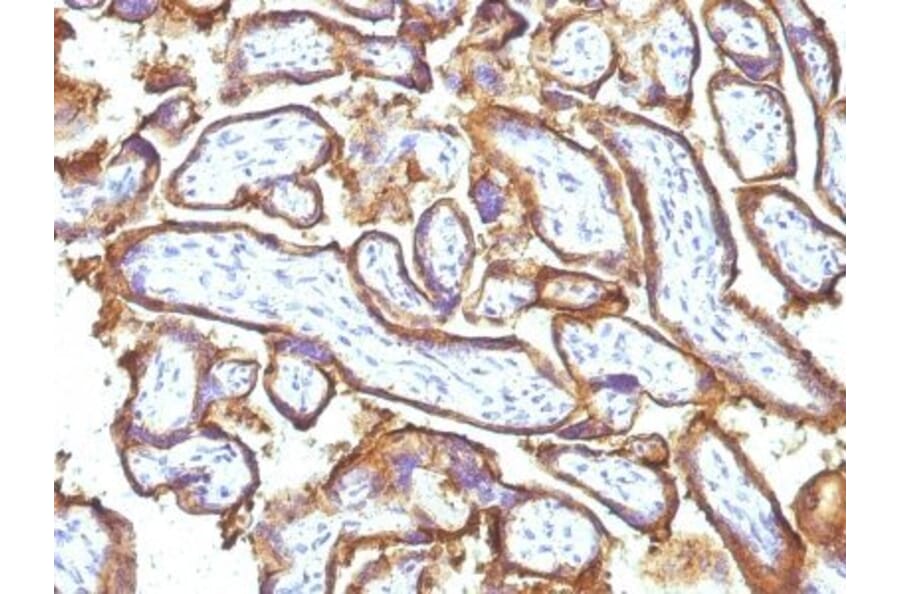 Immunohistochemistry (formalin-fixed, paraffin-embedded) - Anti-EGFR Antibody [GFR1195 + 31G7] (CF®740) (A353194) - Antibodies.com