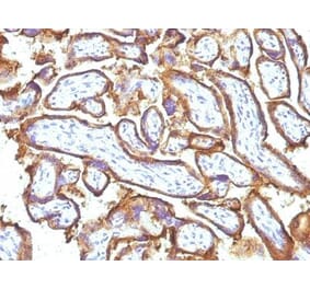 Immunohistochemistry (formalin-fixed, paraffin-embedded) - Anti-EGFR Antibody [GFR1195 + 31G7] (CF®488A) (A353195) - Antibodies.com