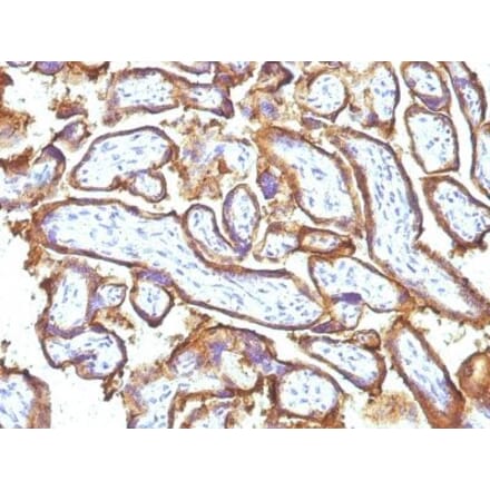 Immunohistochemistry (formalin-fixed, paraffin-embedded) - Anti-EGFR Antibody [GFR1195 + 31G7] (CF®594) (A353196) - Antibodies.com