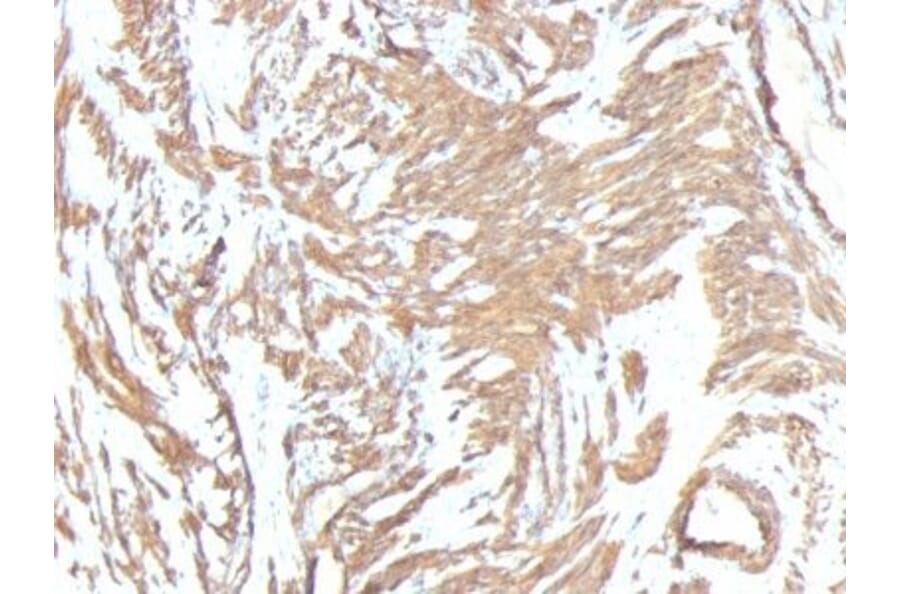 Immunohistochemistry (formalin-fixed, paraffin-embedded) - Anti-alpha Smooth Muscle Actin Antibody [ACTA2/791 + 1A4] (CF®405S) (A353198) - Antibodies.com