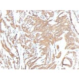 Immunohistochemistry (formalin-fixed, paraffin-embedded) - Anti-alpha Smooth Muscle Actin Antibody [ACTA2/791 + 1A4] (CF®405S) (A353198) - Antibodies.com