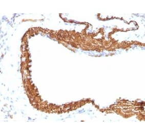 Immunohistochemistry (formalin-fixed, paraffin-embedded) - Anti-alpha Smooth Muscle Actin Antibody [ACTA2/791 + 1A4] (CF®640R) (A353199) - Antibodies.com