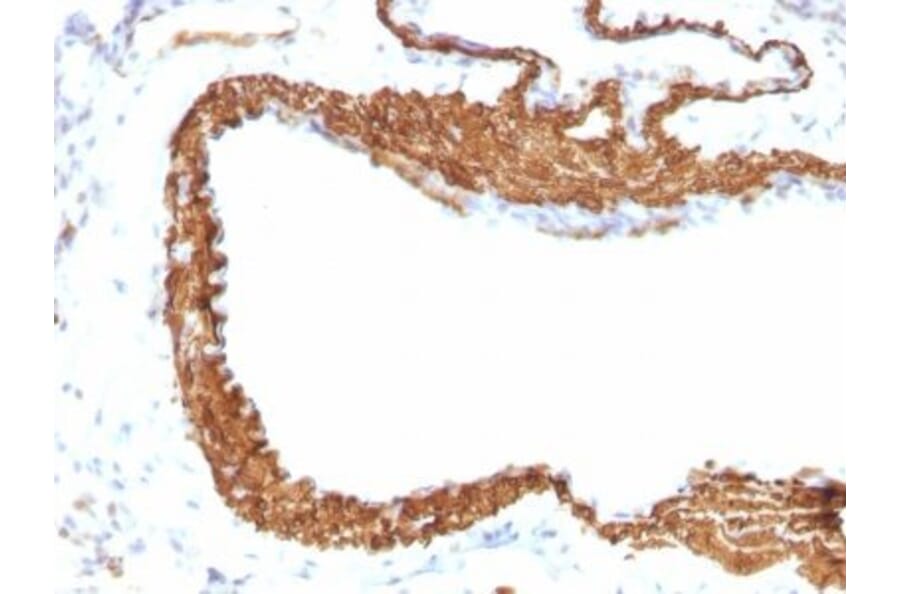 Immunohistochemistry (formalin-fixed, paraffin-embedded) - Anti-alpha Smooth Muscle Actin Antibody [ACTA2/791 + 1A4] (CF®640R) (A353199) - Antibodies.com