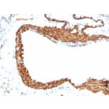 Immunohistochemistry (formalin-fixed, paraffin-embedded) - Anti-alpha Smooth Muscle Actin Antibody [ACTA2/791 + 1A4] (CF®640R) (A353199) - Antibodies.com