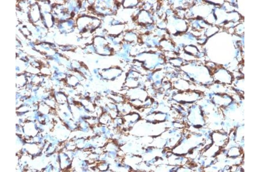 Immunohistochemistry (formalin-fixed, paraffin-embedded) - Anti-alpha Smooth Muscle Actin Antibody [ACTA2/791 + 1A4] (CF®640R) (A353199) - Antibodies.com