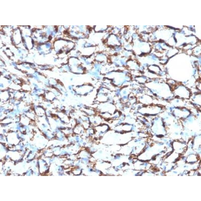 Immunohistochemistry (formalin-fixed, paraffin-embedded) - Anti-alpha Smooth Muscle Actin Antibody [ACTA2/791 + 1A4] (CF®640R) (A353199) - Antibodies.com