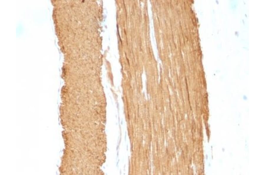 Immunohistochemistry (formalin-fixed, paraffin-embedded) - Anti-alpha Smooth Muscle Actin Antibody [ACTA2/791 + 1A4] (CF®647) (A353200) - Antibodies.com