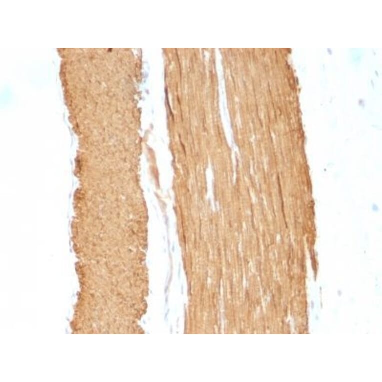 Immunohistochemistry (formalin-fixed, paraffin-embedded) - Anti-alpha Smooth Muscle Actin Antibody [ACTA2/791 + 1A4] (CF®647) (A353200) - Antibodies.com