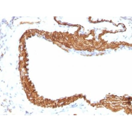 Immunohistochemistry (formalin-fixed, paraffin-embedded) - Anti-alpha Smooth Muscle Actin Antibody [ACTA2/791 + 1A4] (CF®568) (A353201) - Antibodies.com