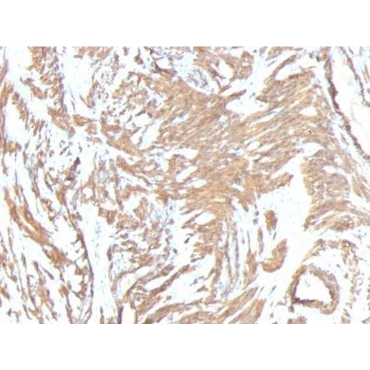 Immunohistochemistry (formalin-fixed, paraffin-embedded) - Anti-alpha Smooth Muscle Actin Antibody [ACTA2/791 + 1A4] (CF®568) (A353201) - Antibodies.com