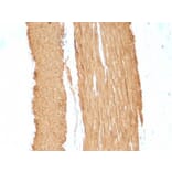 Immunohistochemistry (formalin-fixed, paraffin-embedded) - Anti-alpha Smooth Muscle Actin Antibody [ACTA2/791 + 1A4] (CF®740) (A353202) - Antibodies.com