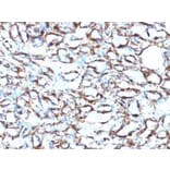 Immunohistochemistry (formalin-fixed, paraffin-embedded) - Anti-alpha Smooth Muscle Actin Antibody [ACTA2/791 + 1A4] (CF®488A) (A353203) - Antibodies.com