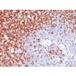 Immunohistochemistry (formalin-fixed, paraffin-embedded) - Anti-CD45RO Antibody [UCHL-1 + T200/797] (CF®640R) (A353207) - Antibodies.com