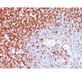 Immunohistochemistry (formalin-fixed, paraffin-embedded) - Anti-CD45RO Antibody [UCHL-1 + T200/797] (CF®647) (A353208) - Antibodies.com