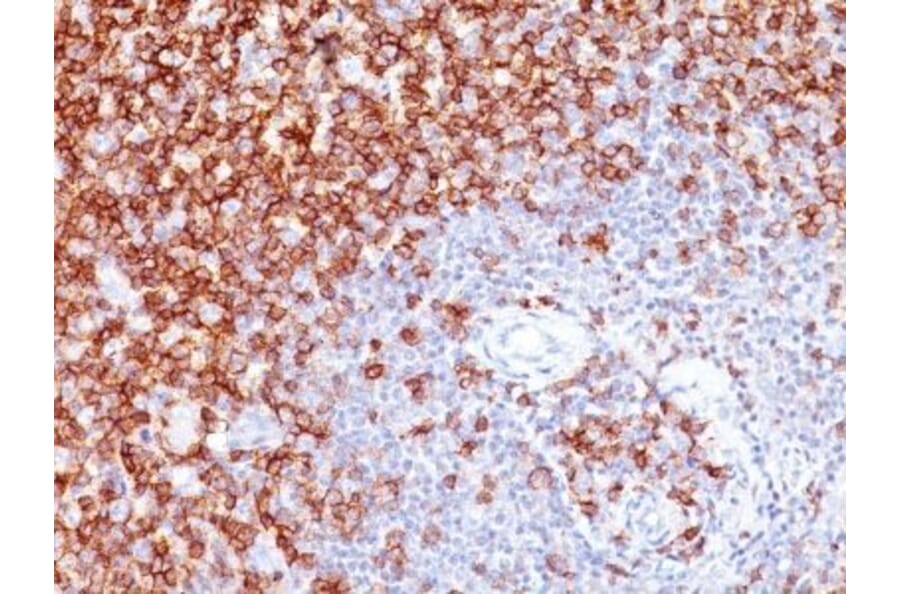 Immunohistochemistry (formalin-fixed, paraffin-embedded) - Anti-CD45RO Antibody [UCHL-1 + T200/797] (CF®488A) (A353211) - Antibodies.com
