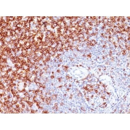 Immunohistochemistry (formalin-fixed, paraffin-embedded) - Anti-CD45RO Antibody [UCHL-1 + T200/797] (CF®594) (A353212) - Antibodies.com