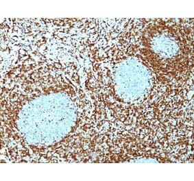 Immunohistochemistry (formalin-fixed, paraffin-embedded) - Anti-Bcl-2 Antibody [100/D5 + 124] (CF®640R) (A353215) - Antibodies.com