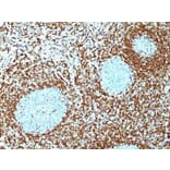 Immunohistochemistry (formalin-fixed, paraffin-embedded) - Anti-Bcl-2 Antibody [100/D5 + 124] (CF®647) (A353216) - Antibodies.com