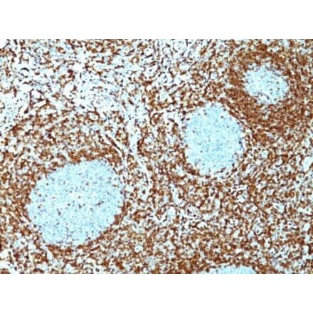 Immunohistochemistry (formalin-fixed, paraffin-embedded) - Anti-Bcl-2 Antibody [100/D5 + 124] (CF®568) (A353217) - Antibodies.com
