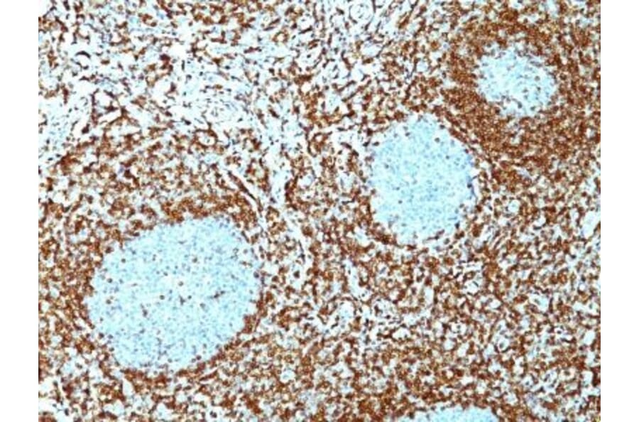 Immunohistochemistry (formalin-fixed, paraffin-embedded) - Anti-Bcl-2 Antibody [100/D5 + 124] (CF®488A) (A353219) - Antibodies.com