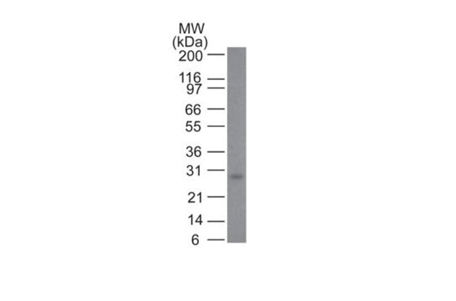 Wstern Blot - Anti-Bcl-2 Antibody [100/D5 + 124] (CF®488A) (A353219) - Antibodies.com