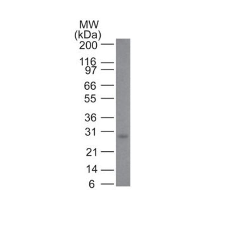 Wstern Blot - Anti-Bcl-2 Antibody [100/D5 + 124] (CF®594) (A353220) - Antibodies.com