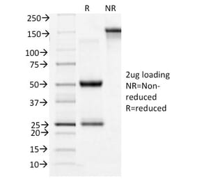 SDS-PAGE - Anti-Transferrin Receptor Antibody [TFRC/1396] (CF®740) (A353242) - Antibodies.com