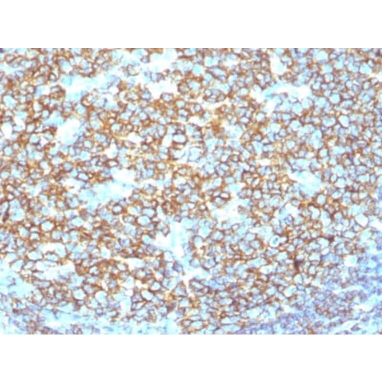 Immunohistochemistry (formalin-fixed, paraffin-embedded) - Anti-CD20 Antibody [IGEL/1497R] (CF®405S) (A353320) - Antibodies.com