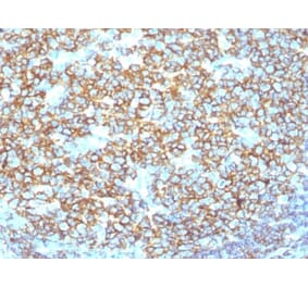 Immunohistochemistry (formalin-fixed, paraffin-embedded) - Anti-CD20 Antibody [IGEL/1497R] (CF®488A) (A353325) - Antibodies.com