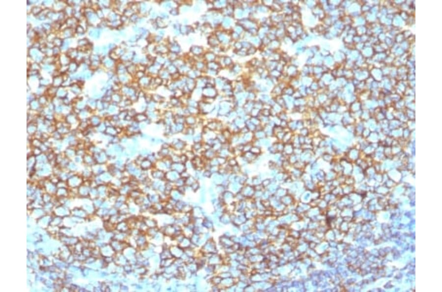 Immunohistochemistry (formalin-fixed, paraffin-embedded) - Anti-CD20 Antibody [IGEL/1497R] (CF®488A) (A353325) - Antibodies.com