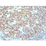 Immunohistochemistry (formalin-fixed, paraffin-embedded) - Anti-CD20 Antibody [IGEL/1497R] (CF®594) (A353326) - Antibodies.com