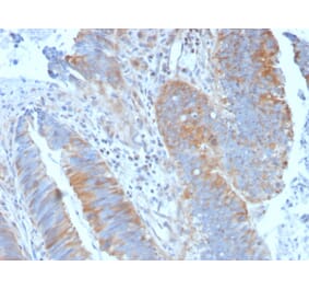 Immunohistochemistry (formalin-fixed, paraffin-embedded) - Anti-CD20 Antibody (CF®405S) (A353328) - Antibodies.com