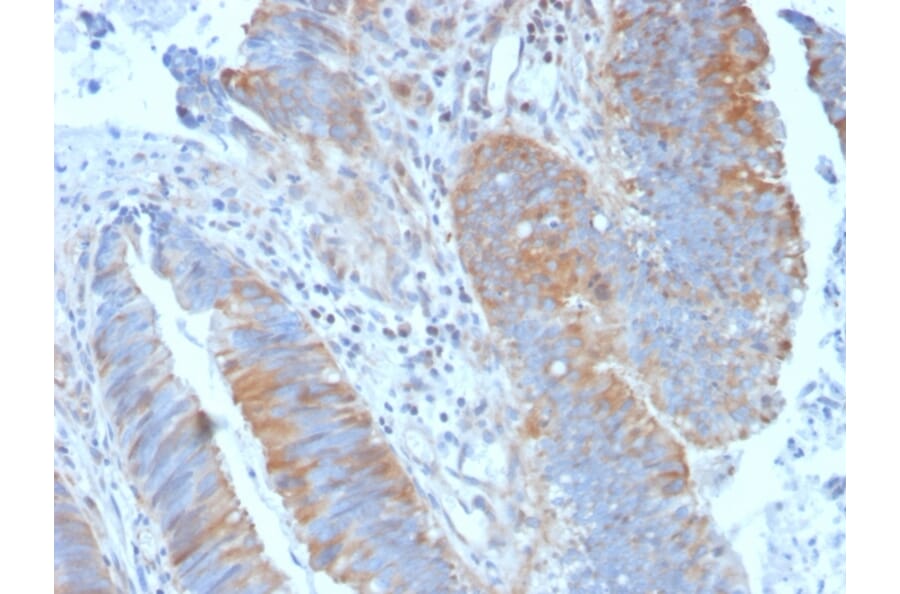 Immunohistochemistry (formalin-fixed, paraffin-embedded) - Anti-CD20 Antibody (CF®405S) (A353328) - Antibodies.com