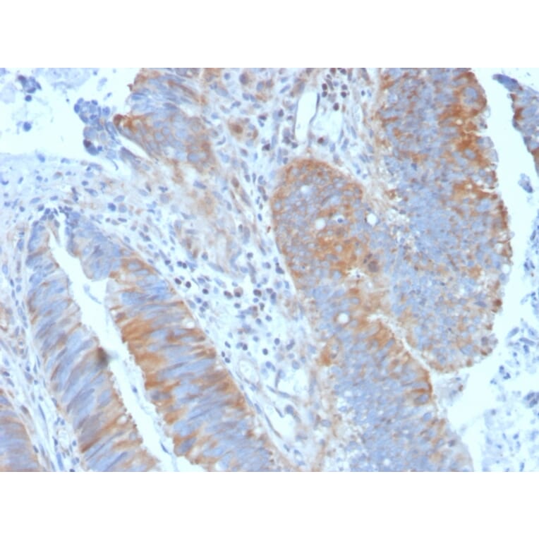 Immunohistochemistry (formalin-fixed, paraffin-embedded) - Anti-CD20 Antibody (CF®405S) (A353328) - Antibodies.com