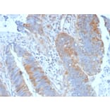 Immunohistochemistry (formalin-fixed, paraffin-embedded) - Anti-CD20 Antibody (CF®405S) (A353328) - Antibodies.com