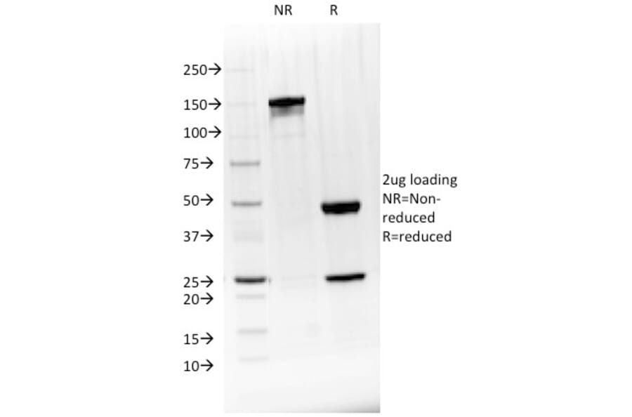 SDS-PAGE - Anti-CD20 Antibody (CF®640R) (A353329) - Antibodies.com