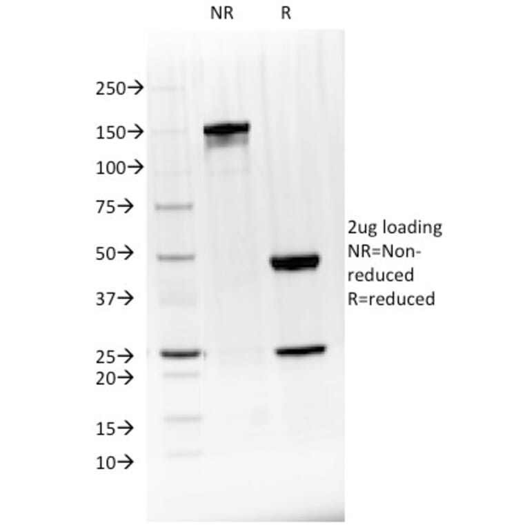 SDS-PAGE - Anti-CD20 Antibody (CF®640R) (A353329) - Antibodies.com