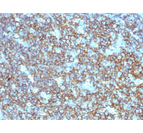 Immunohistochemistry (formalin-fixed, paraffin-embedded) - Anti-CD20 Antibody (CF®647) (A353330) - Antibodies.com