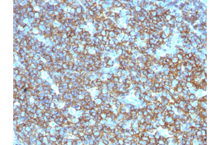 Immunohistochemistry (formalin-fixed, paraffin-embedded) - Anti-CD20 Antibody (CF®647) (A353330) - Antibodies.com