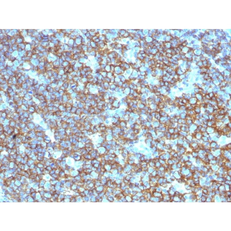 Immunohistochemistry (formalin-fixed, paraffin-embedded) - Anti-CD20 Antibody (CF®647) (A353330) - Antibodies.com