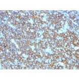 Immunohistochemistry (formalin-fixed, paraffin-embedded) - Anti-CD20 Antibody (CF®647) (A353330) - Antibodies.com