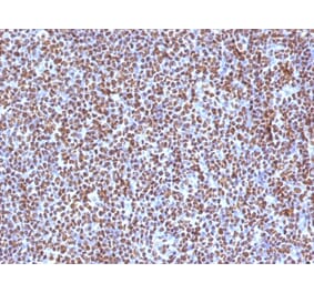 Immunohistochemistry (formalin-fixed, paraffin-embedded) - Anti-CD20 Antibody (CF®740) (A353332) - Antibodies.com