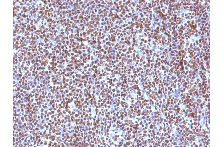 Immunohistochemistry (formalin-fixed, paraffin-embedded) - Anti-CD20 Antibody (CF®488A) (A353333) - Antibodies.com