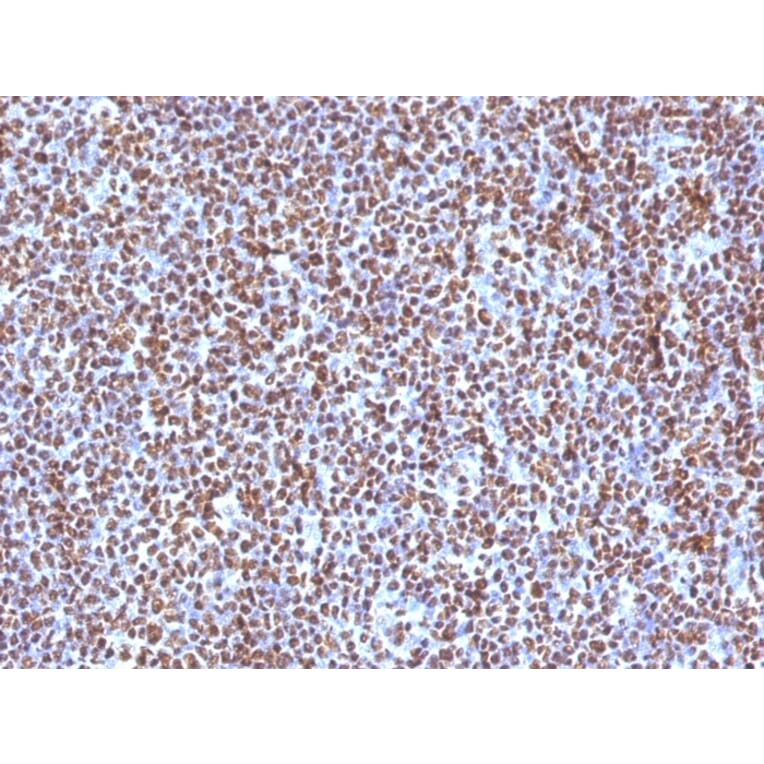 Immunohistochemistry (formalin-fixed, paraffin-embedded) - Anti-CD20 Antibody (CF®488A) (A353333) - Antibodies.com