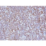 Immunohistochemistry (formalin-fixed, paraffin-embedded) - Anti-CD20 Antibody (CF®594) (A353334) - Antibodies.com