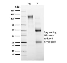 SDS-PAGE - Anti-CD4 Antibody [CD4/1604] (CF®740) (A353396) - Antibodies.com